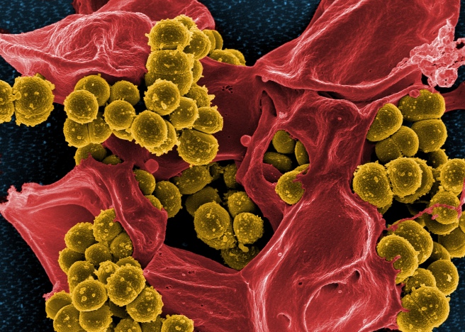 A scanning electron micrograph of methicillin-resistant Staphylococcus aureus and dead human immune cells. (Credit: National Institute of Allergy and Infectious Diseases. CC BY 2.0)
