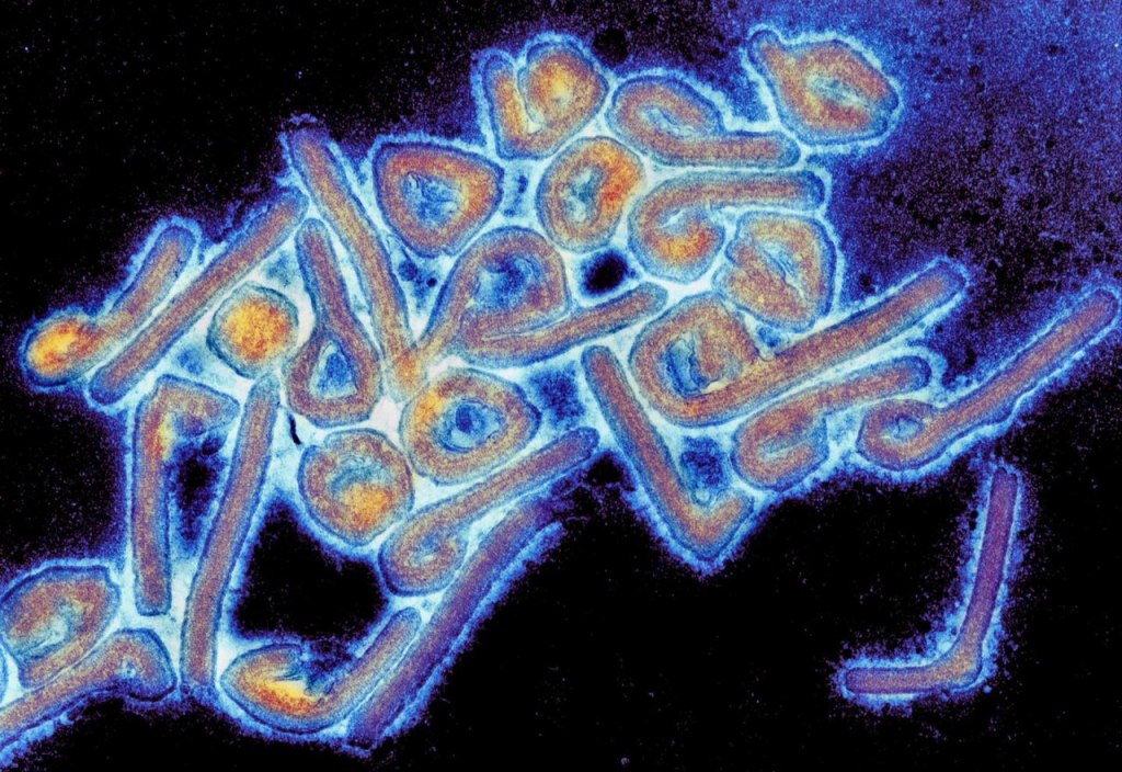 A micrograph of Marburg virus